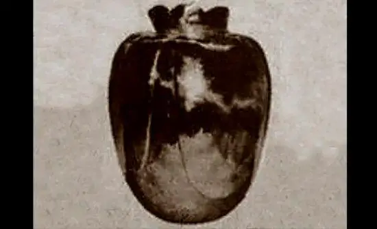 A reported picture of the Basano Vase.